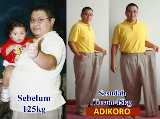 Cara menurunkan berat badan tanpa sedot lemak