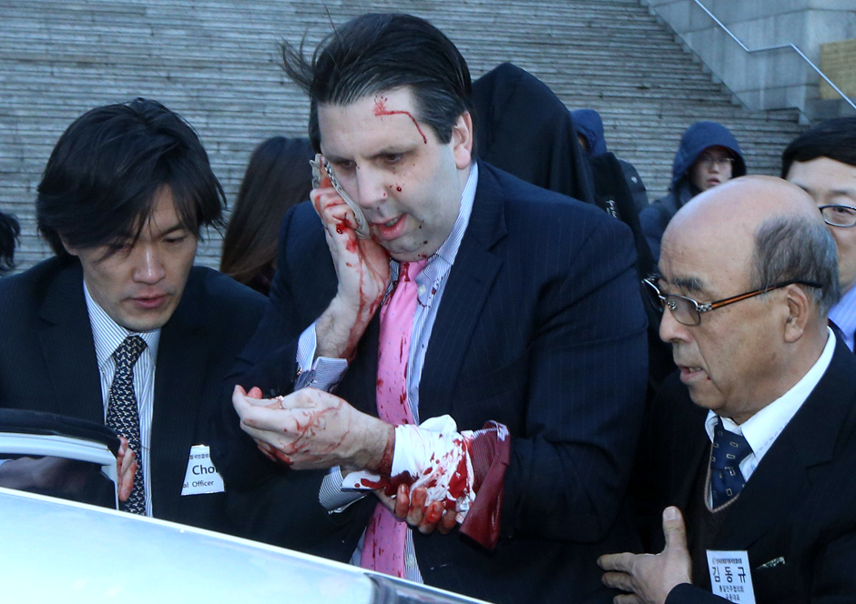Mark Lippert herido en Corea del Sur