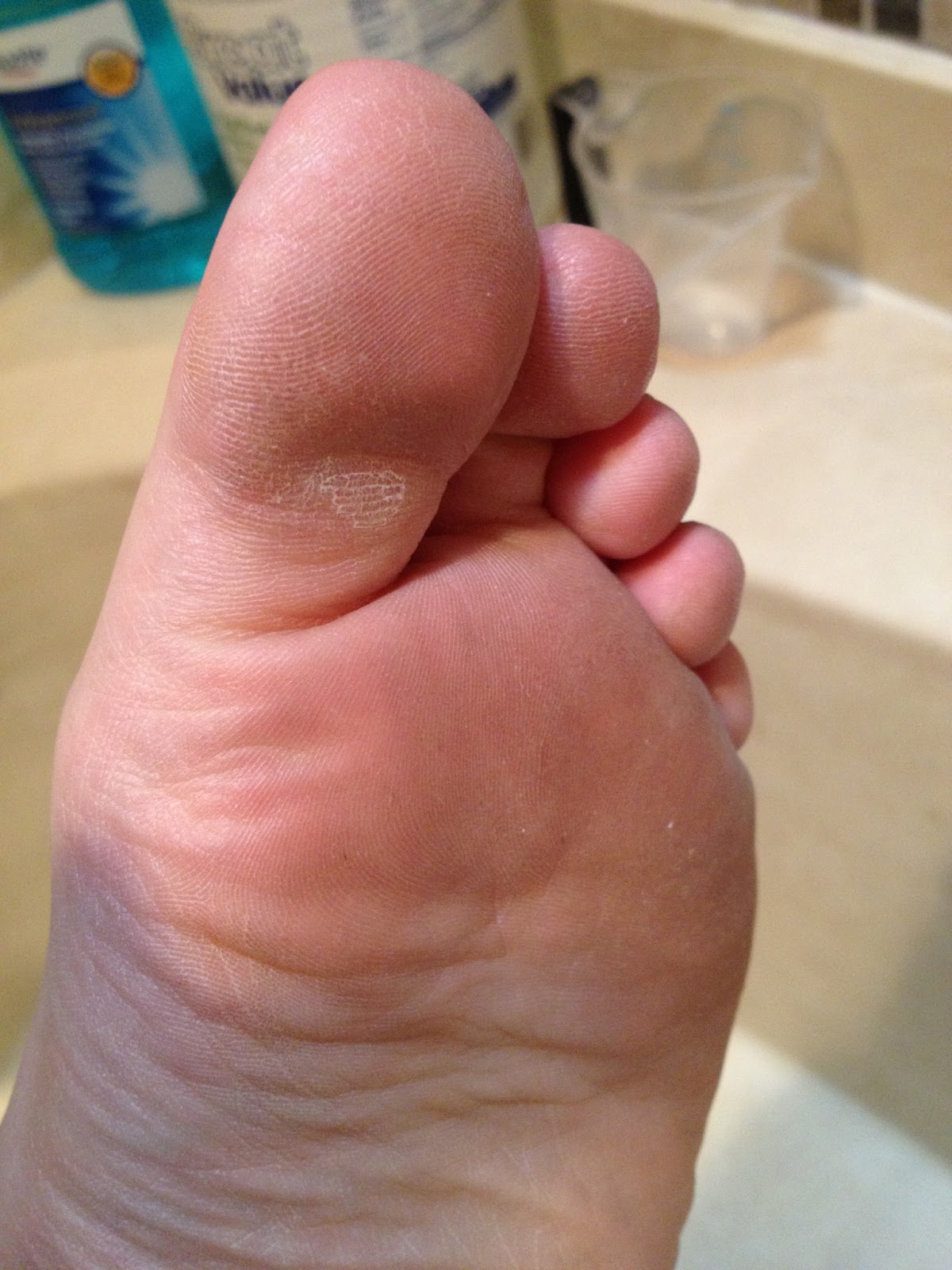 pinteresting-summer-vinegar-and-listerine-foot-soak-and-i-apologize-in