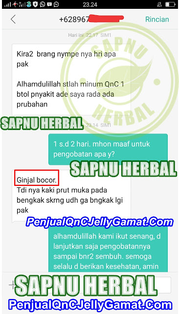 Cara Mengobati Ginjal Bocor Secara Alami Agar Cepat Sembuh Cara Mengobati Ginjal Bocor Secara Alami Agar Cepat Sembuh