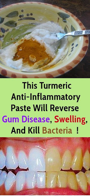 Start Brushing With Turmeric Toothpaste And Watch What Happens To Plaque And Gum Disease