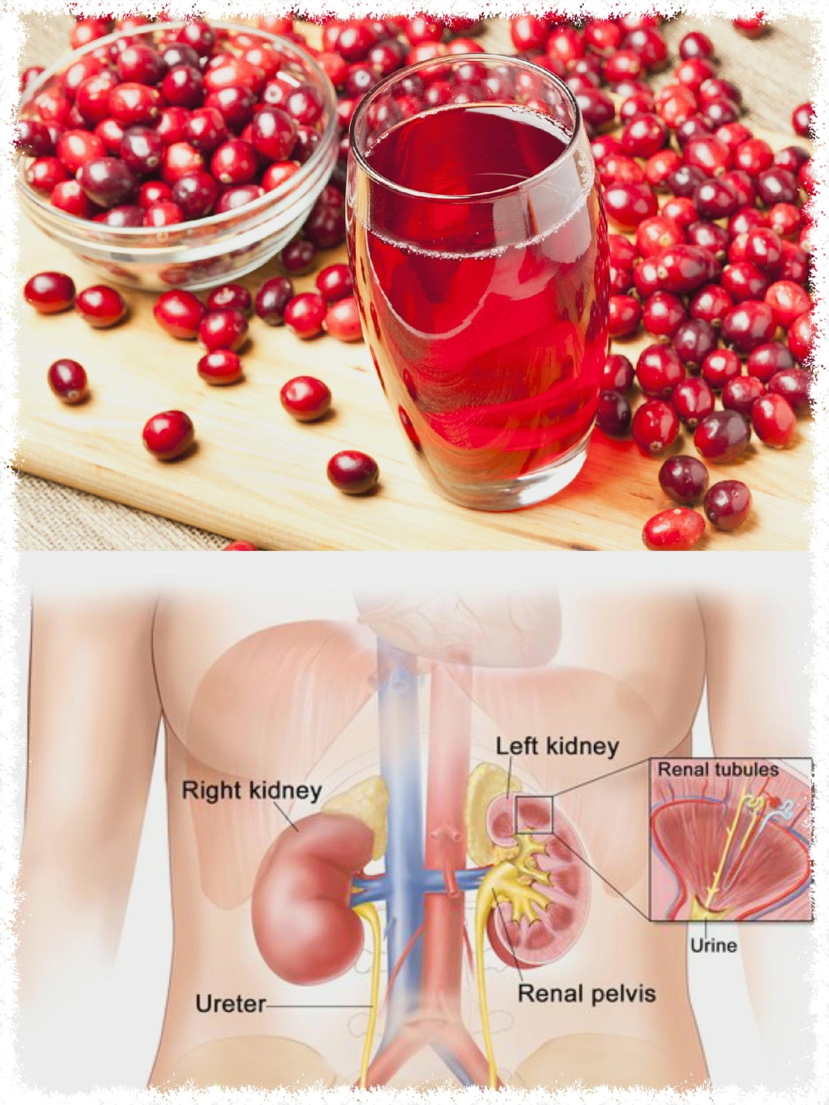 5 Drinks That Cleanse Kidneys And Bloodstream NATURAL REMEDIES