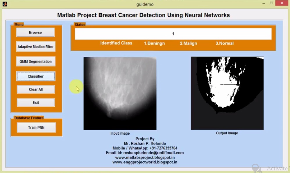 Breast Cancer Detection Using Neural Networks Matlab Project With