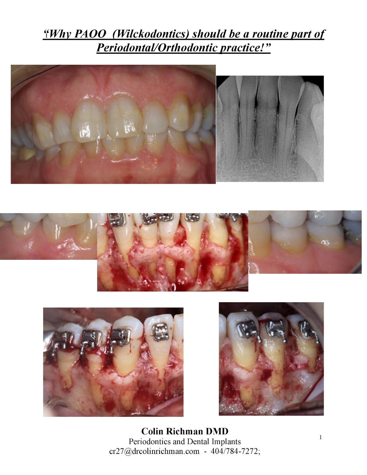 The POPA Blog Why PAOO™ Should Be A Routine Part of Periodontal