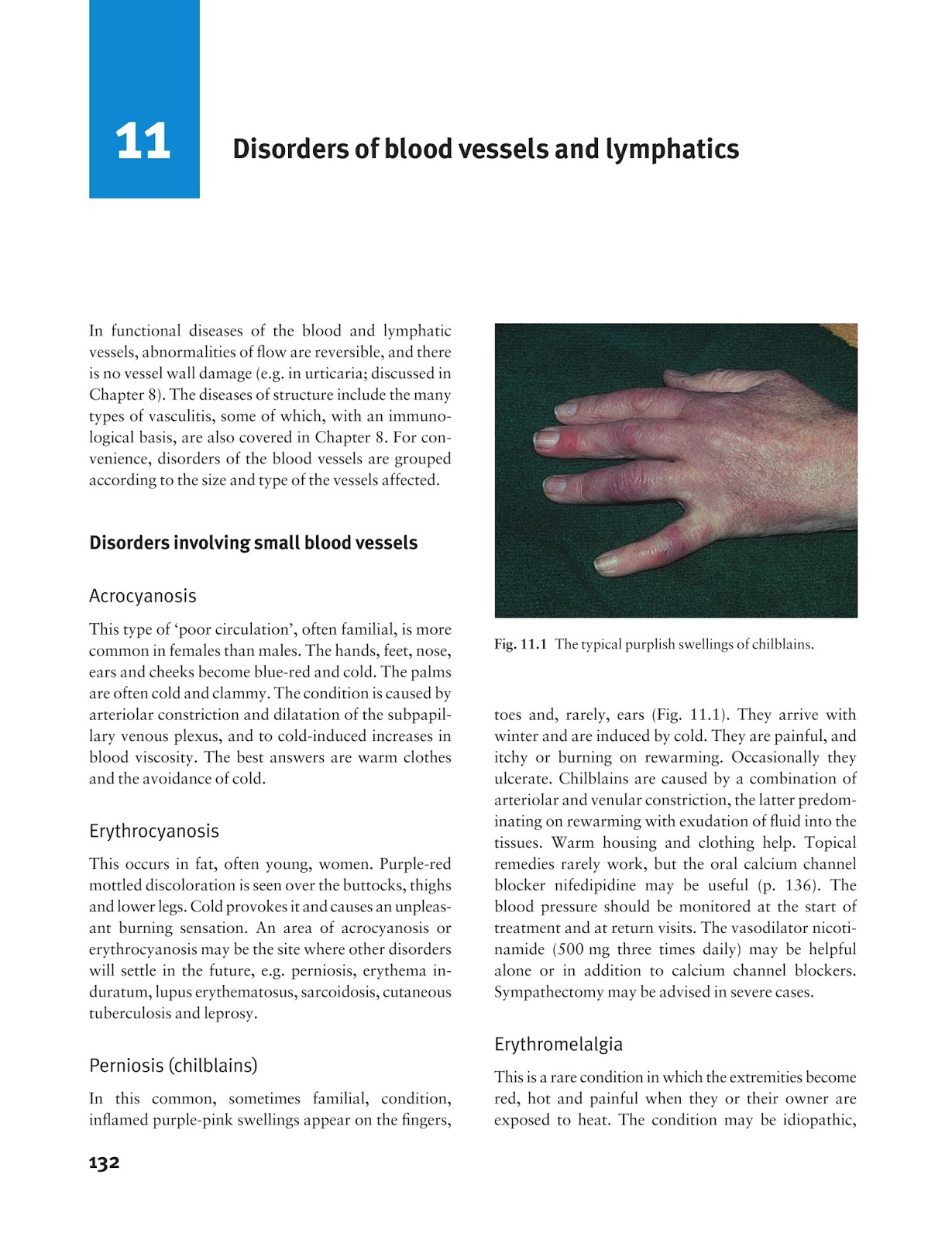 triamcinolone acetonide cream for scalp psoriasis