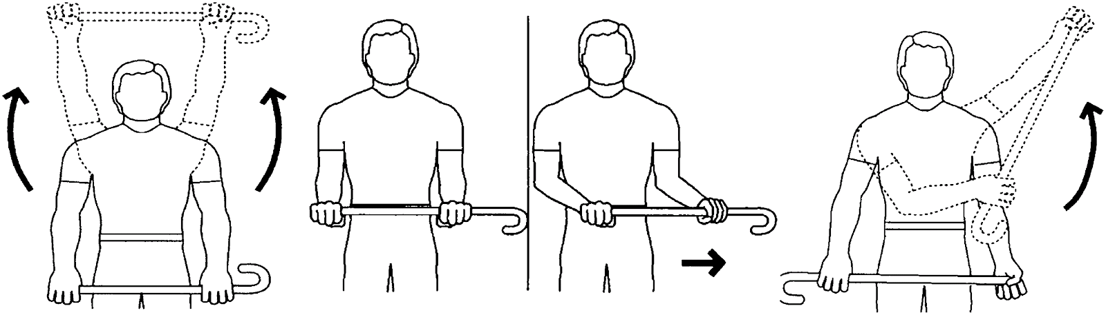 Design Sensible: Frozen shoulder update and ideas for exercises.