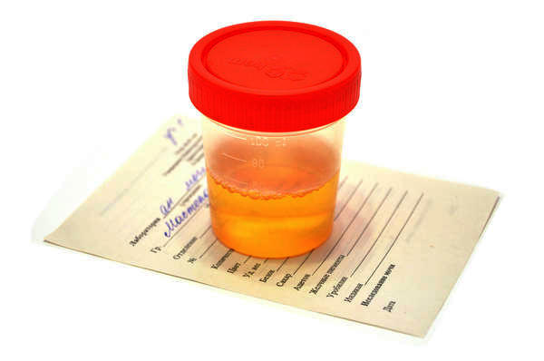 what can cause blood in urine what can cause blood in urine