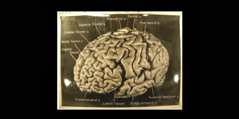 Otak Einstein