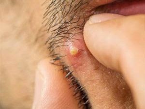 Έβγαλες καλόγερο;