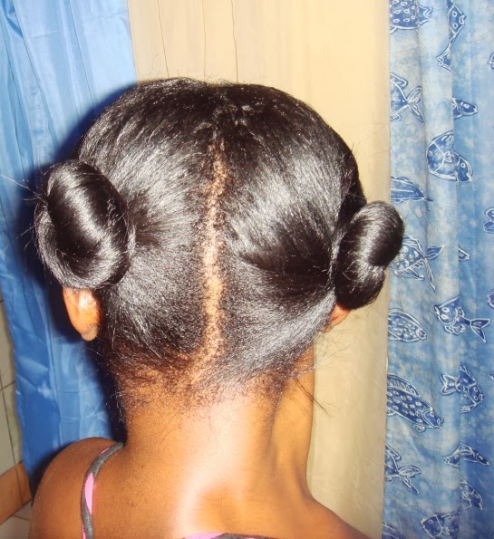 forcapil avant apres