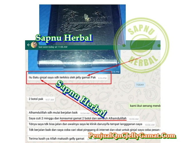 Cara Menghancurkan Batu Ginjal Yang Besar Tanpa Operasi Sampai Tuntas Cara Menghancurkan Batu Ginjal Yang Besar Tanpa Operasi Sampai Tuntas