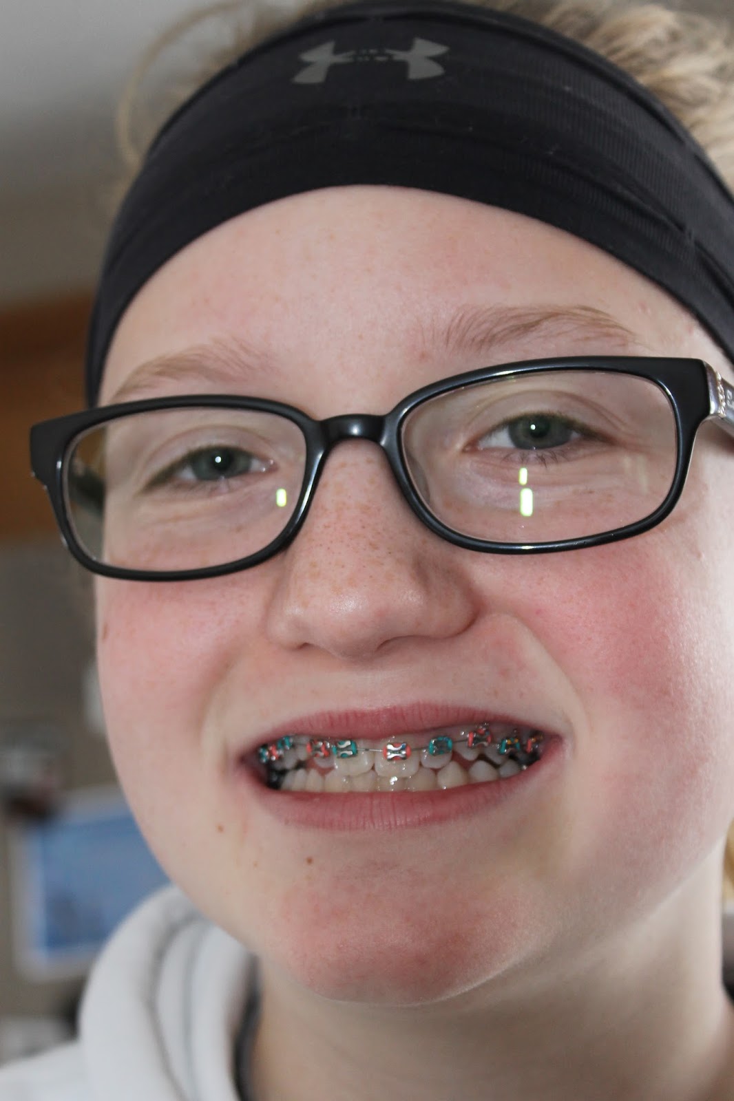 Three Votes to One no more braces