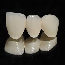 Răng sứ cercon_vật liệu làm răng sứ hiệu quả Rang-su-cercon-vat-lieu-lam-rang-su-hieu-qua-1