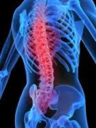 Nursing Management of Low Back Pain
