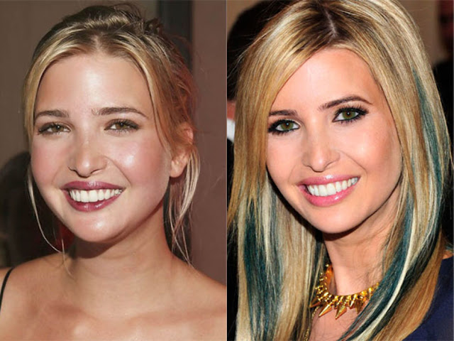 ivanka-trump-before-and-after