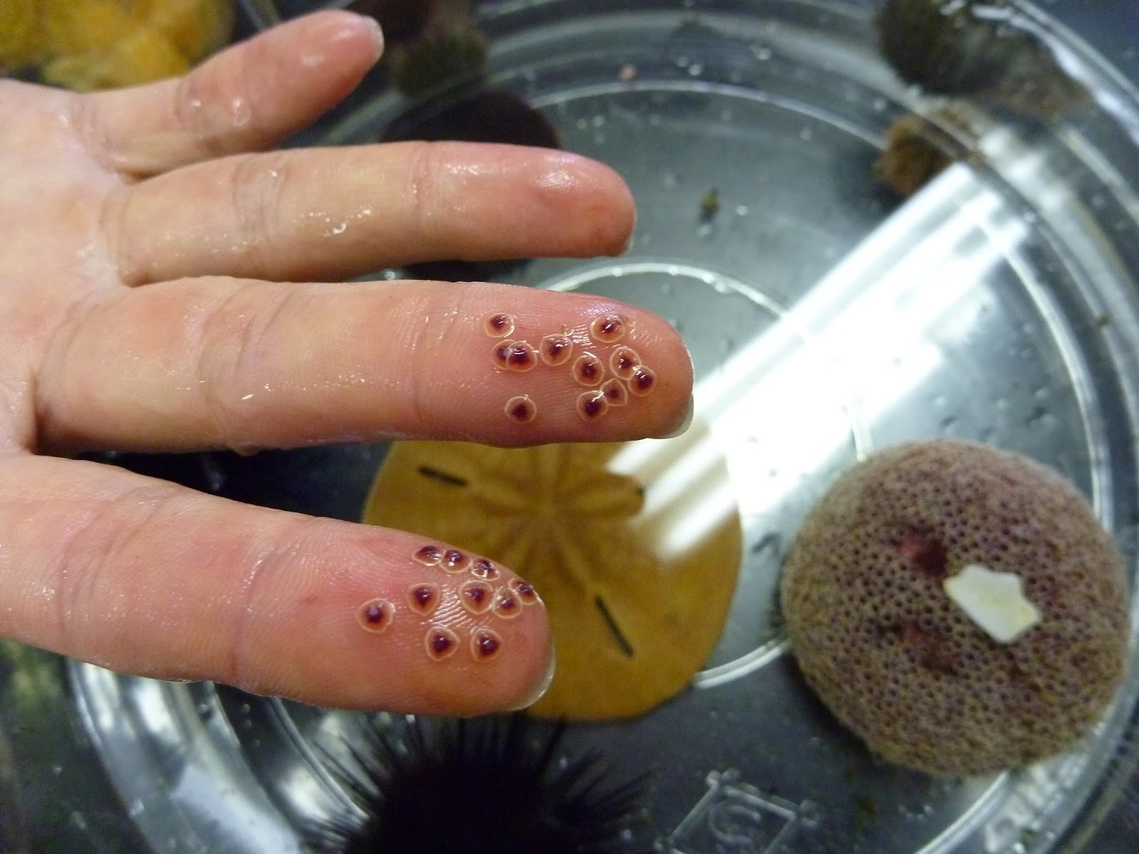 The Echinoblog What we know about the world's most venomous sea urchin
