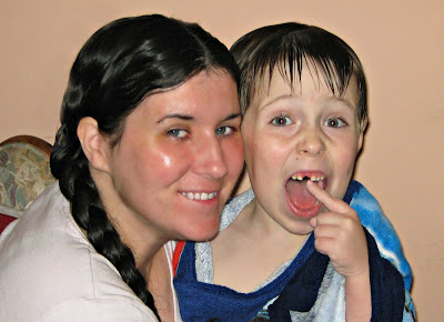 Mother and son, who has a missing front tooth
