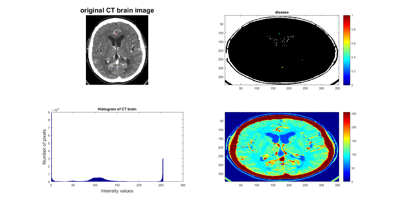 Biomedical Signal and Image Processing projects using Matlab and