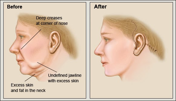 Best Short Hairstyle Jowls Mau Tahu O