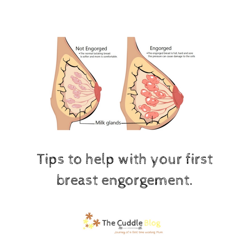 Tips for dealing with engorgement