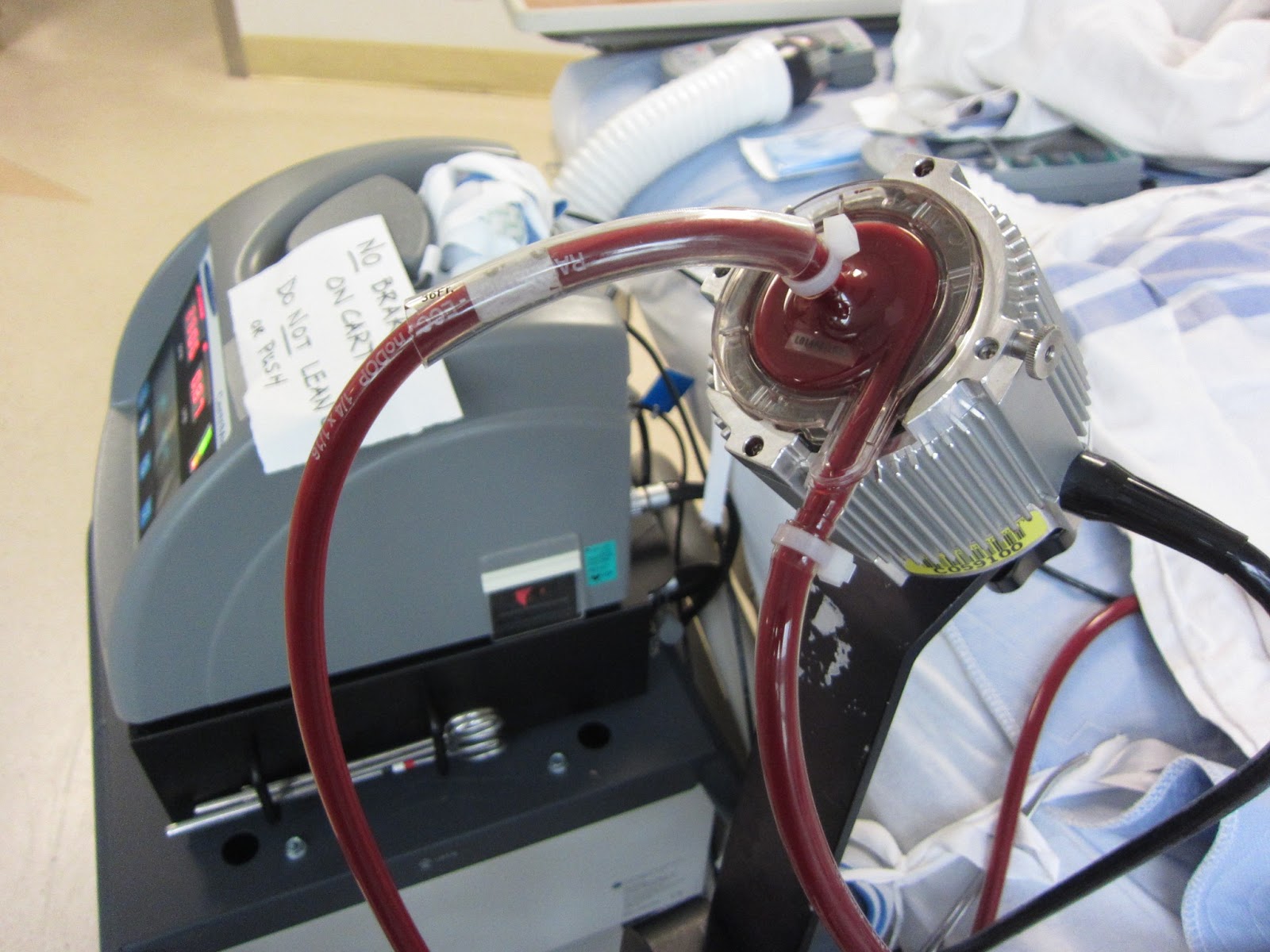 Heart for Sara About Sara's Heart Defect