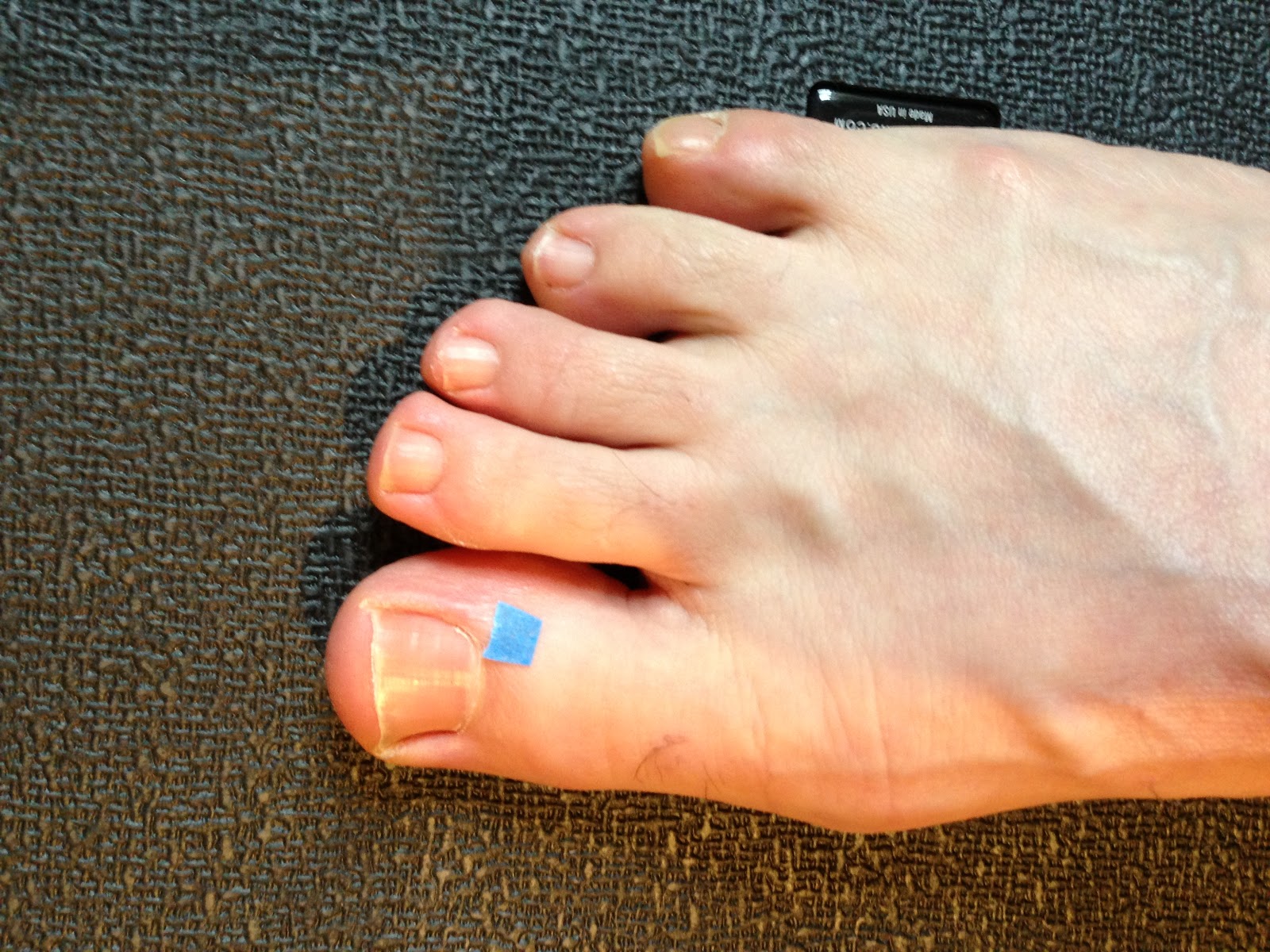 Back In Action Jetlag acupuncture points for traveling