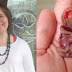 MÃE SOFRE ABORTO ESPONTÂNEO E POSTA FOTO DO BEBÊ DE 11 SEMANAS COM UMA MENSAGEM EMOCIONANTE, VEJA