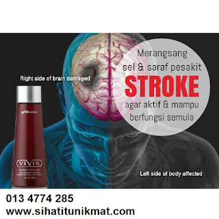 rawatan untuk stroke
