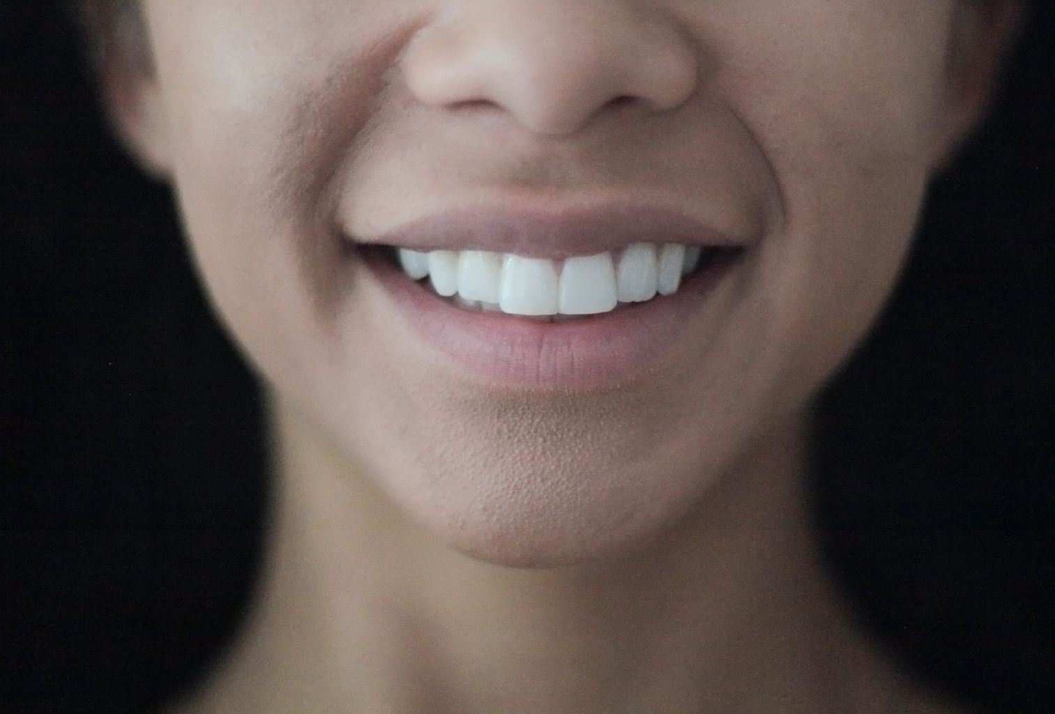 New Nashers Enlighten Teeth Whitening Review — The Southampton Girl