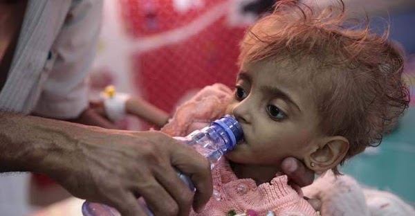 Unos 85.000 niños han fallecido de hambre en Yemen en los últimos cuatro años Unos 85.000 niños han fallecido de hambre en Yemen en los últimos cuatro años