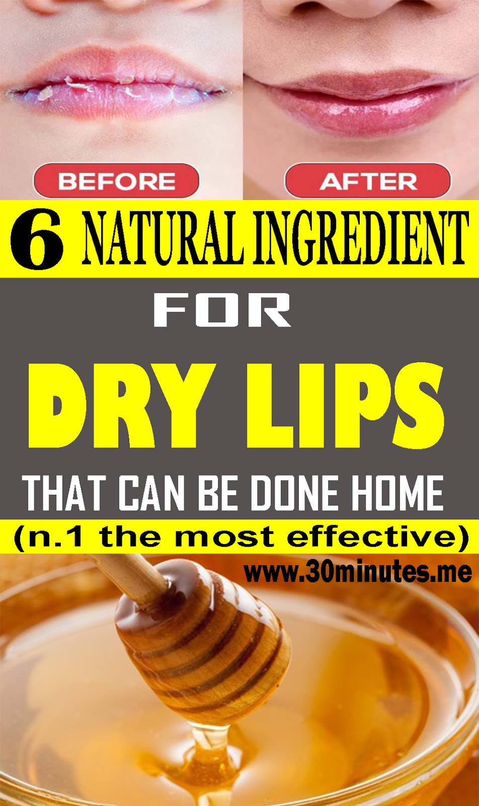 From Honey To Rose Petals, Here Are 6 AtHome Remedies To Soothe Dry