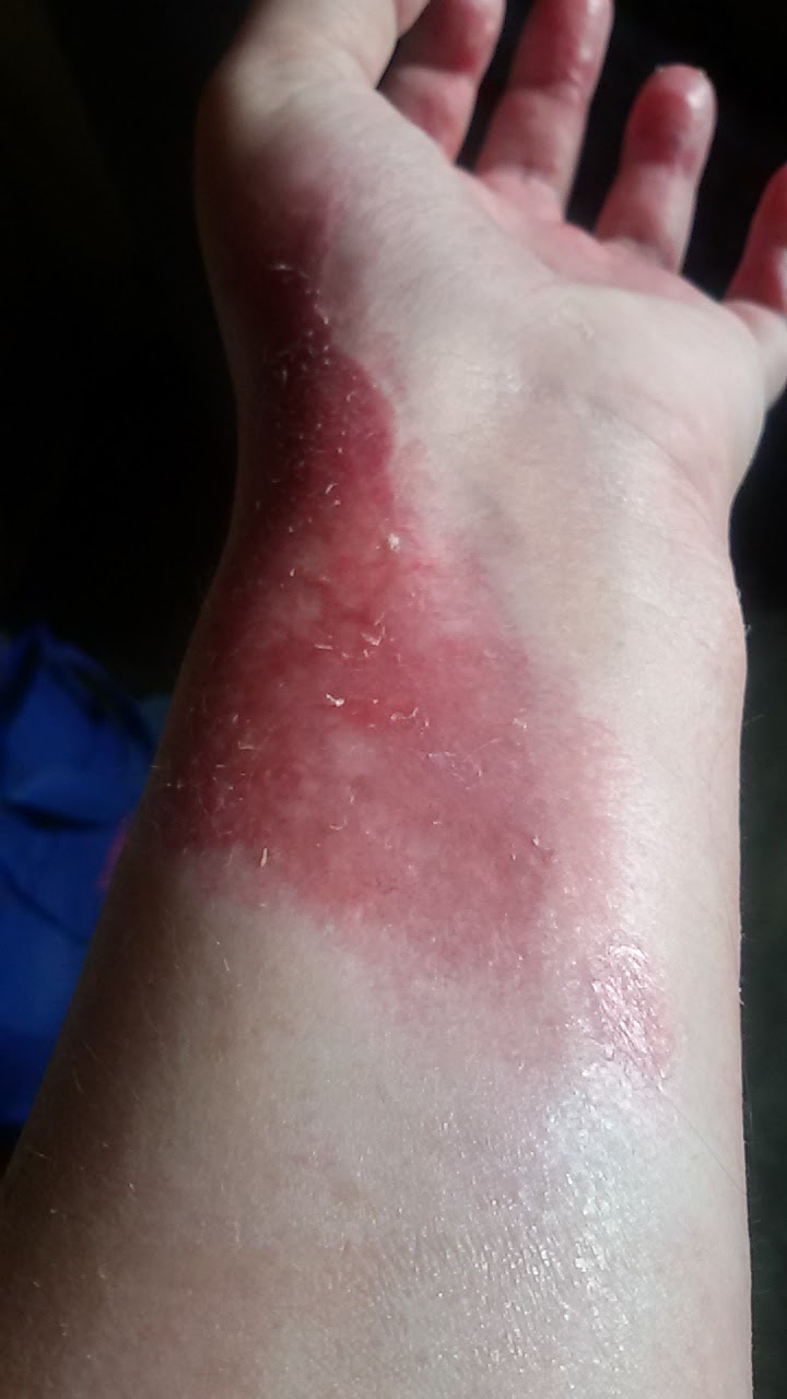 DeckleEdged The Healing Power of Papaya