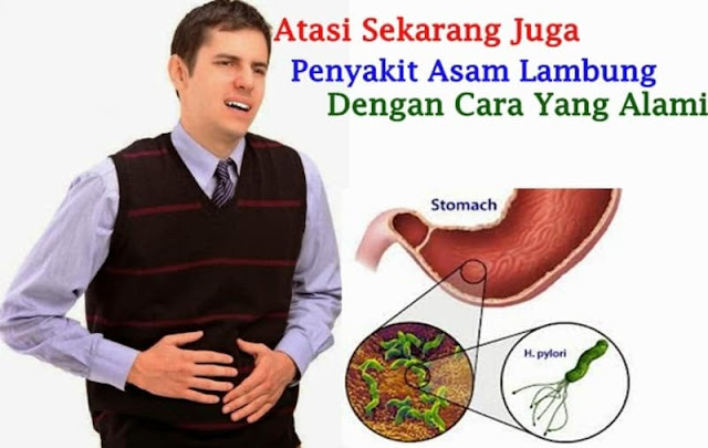 Waspada, Inilah Penyebab Asam Lambung Naik yang Banyak Dilanggar Orang Waspada, Inilah Penyebab Asam Lambung Naik yang Banyak Dilanggar Orang