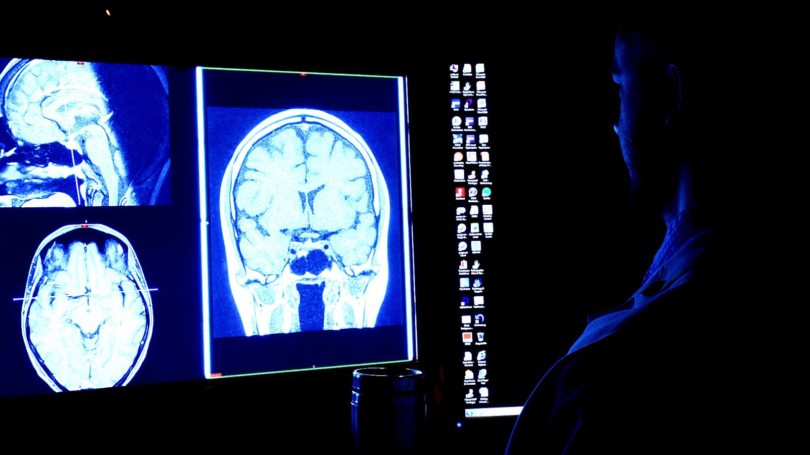 How Long Does Radiology School Take Radio Choices