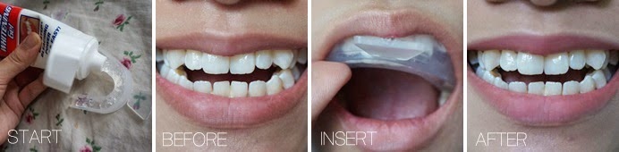 Teeth Whitening Plus White 5 Minute Bleach Gel Review Sabrina Tajudin Malaysia Beauty Lifestyle Blog