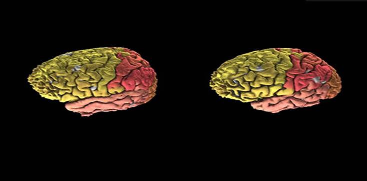 LA HORA DEL SAPO: BRAIN EXPLORER 2: EL PRIMER ATLAS 3D INTERACTIVO DEL ...