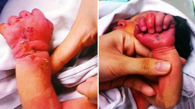 Bukanya Insyaf Ketahuan Selingkuh, Perempuan ini Malah Tusuk Perut Anaknya dengan Pecahan Kaca Bukanya Insyaf Ketahuan Selingkuh, Perempuan ini Malah Tusuk Perut Anaknya dengan Pecahan Kaca