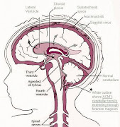 Chiari in a child