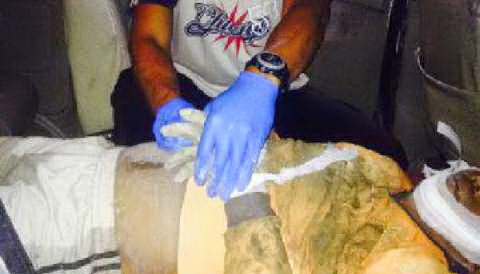 Buruh Proyek di Tabanan Tewas Tersengat Listrik