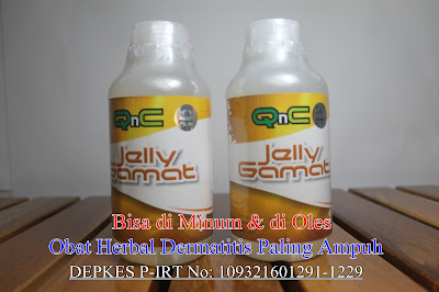 Cara Ampuh Menyembuhkan Dermatitis Secara Alami Cara Ampuh Menyembuhkan Dermatitis Secara Alami