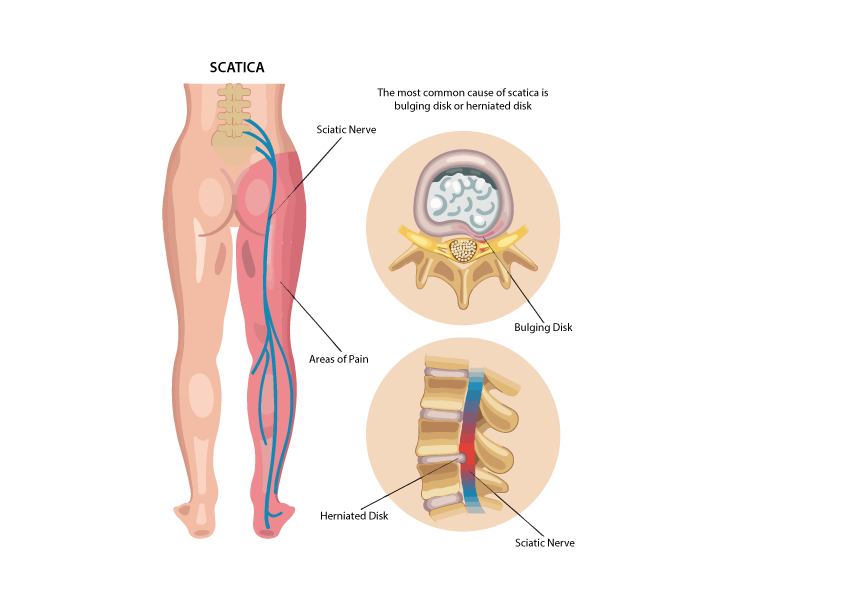 Ayurveda Kerala Treatment Center India BEST NATURAL AYURVEDIC CURE FOR