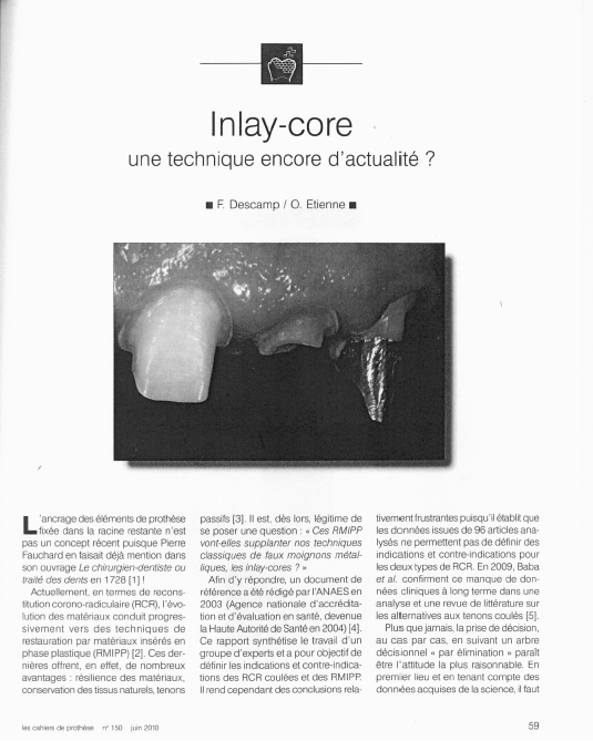 Dental ebooks: inlay-core (cahiers de prothèse n 150 juin 2010)