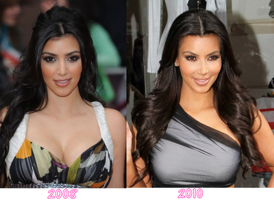 Celebrities of 2012: Kim Kardashian Before and After Plastic Surgery