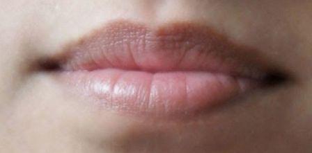 6 Cara Alami Menghilangkan Bibir Hitam