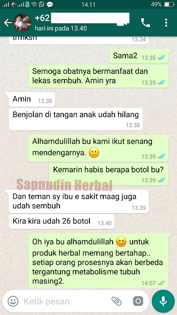 obat benjolan dibawah lidah obat benjolan dibawah lidah