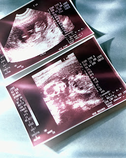 Ultrasound, Sonogram, Baby, Pregnancy