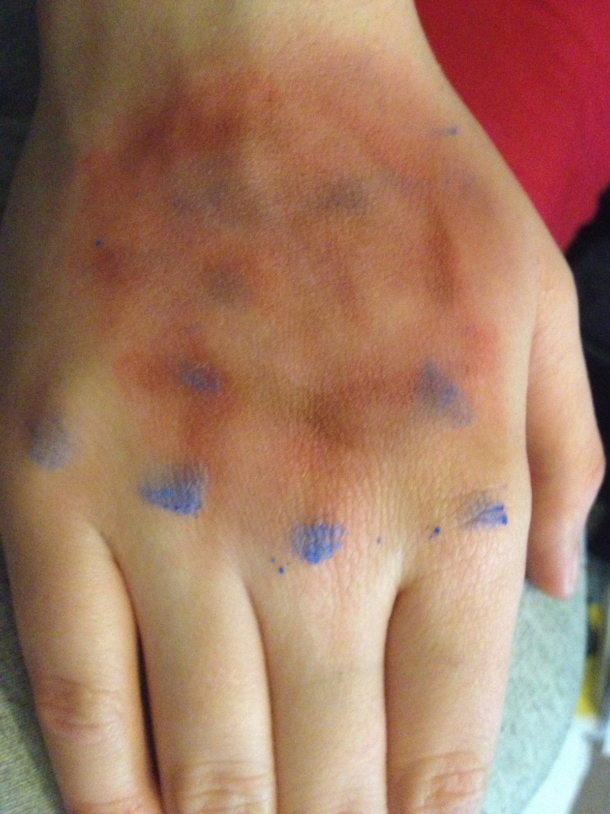 Caitlyn, Ellie and Stacey Practical task Special Effects Bruises