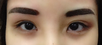 Eyebrow Embroidery at CLD (Celebrity Dream) Beauty after korean brows review
