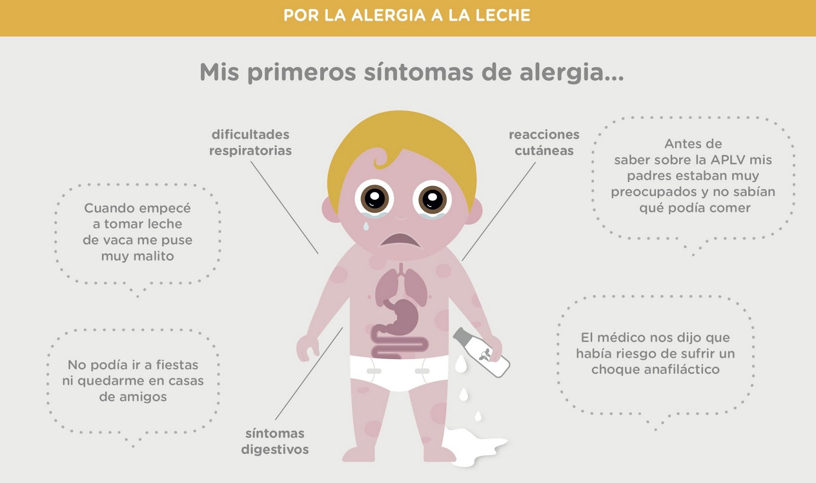 No sin mis hijos: Alergia a la leche: lo que necesitas saber