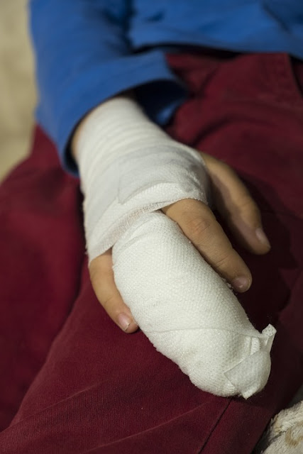 pixabay.com/en/child-boy-injury-injured-2737064